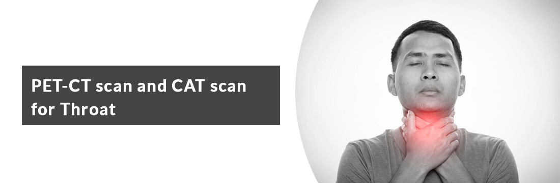 PET-CT scan and CAT scan for Throat